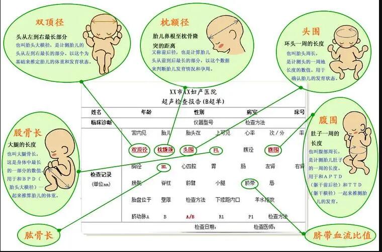 双顶径(BPD)、腹围(AC)、股骨长(FL)、枕额径(OFD)、头围(HC)是什么标准